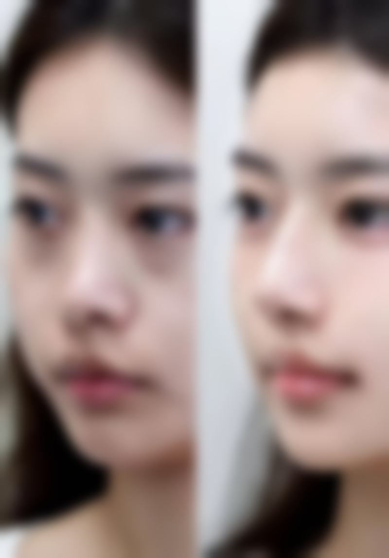 韩国BA整形外科医院价格表/收费标准一览