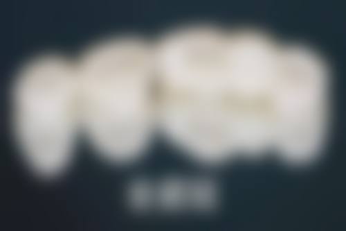 深圳植牙推薦小紅書:揀邊間診所好?關鍵睇呢3點!