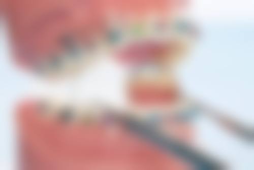 拓展延伸:珠海整牙真相 + 避坑指南