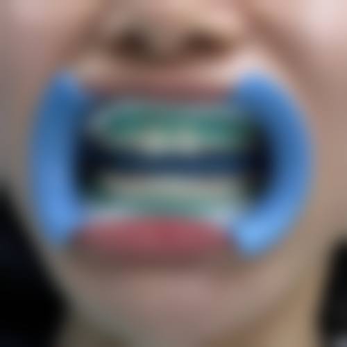 雁塔海涛口腔医院正规可靠吗?