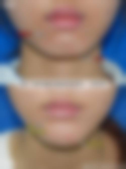 广州中 医 药大学第一附属医院医疗美容科地理位置便于到院。