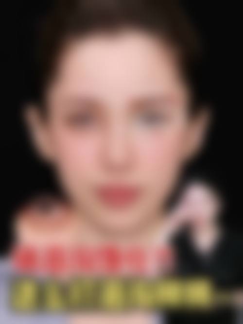 广州中 医 药大学第一附属医院医疗美容科擅长项目。