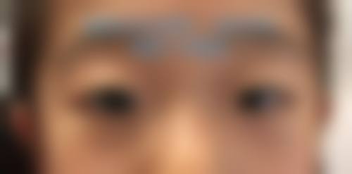 北京美和眼科治疗反馈与口碑评价。
