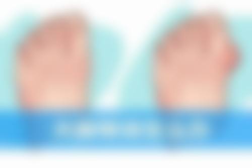 韓國TS預約流程分享:適合邊類人群?