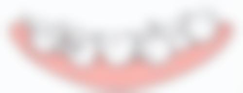 珠海拜博全瓷牙冠推薦：常見問題Q&A