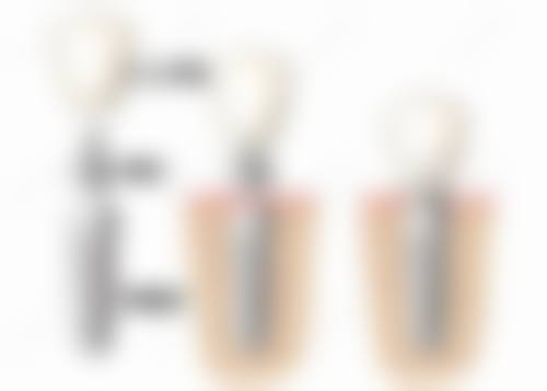 江苏宿迁博尔口腔门诊部预约挂号方式。