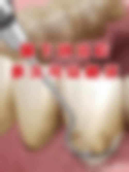 江苏宿迁博尔口腔门诊部治疗反馈与口碑评价。