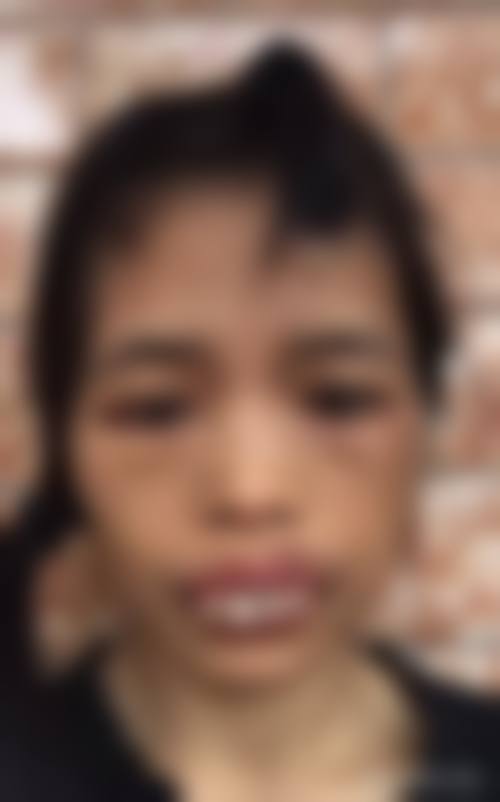 患者真实评价