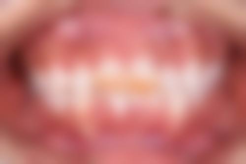 常见问题解答(FAQ)