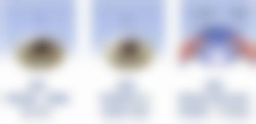 优惠活动详情:白内障手术限时特别优惠