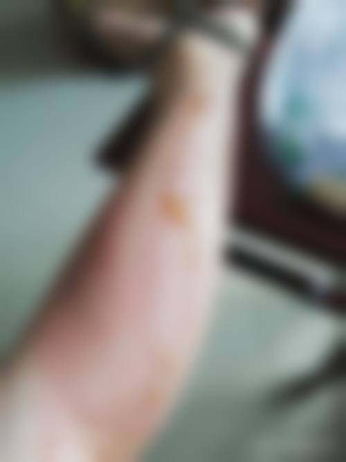 患者常见问题解答(精选)