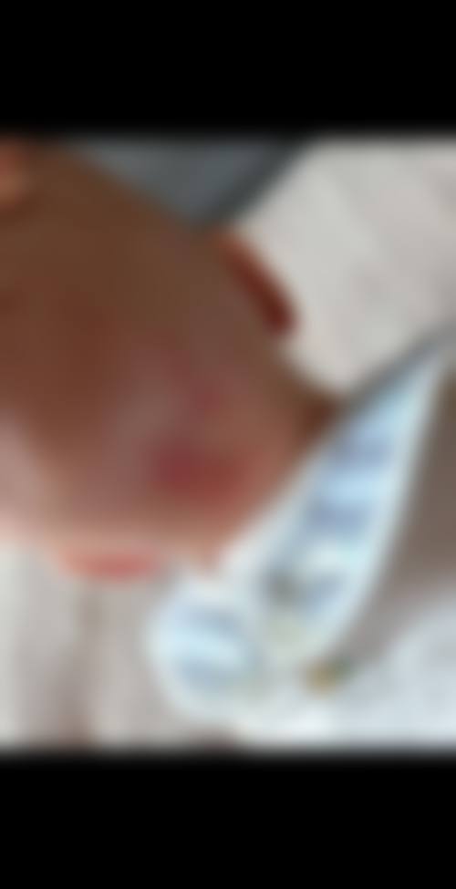 北京小美微甄整形医院正规可靠吗?