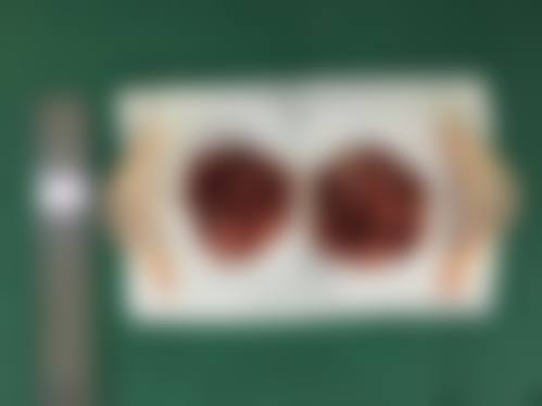 西安交通大学医学校第一附属医院烧伤整形美容科治疗反馈与口碑评价。