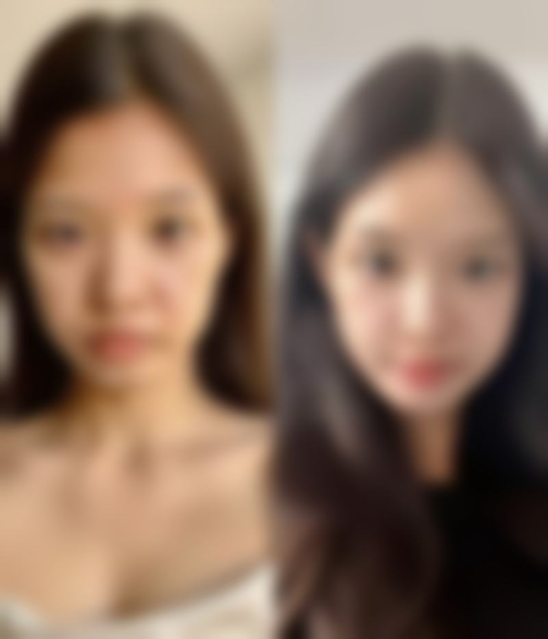 韓國healing眼科醫院怎麼預約掛號:避坑貼士(港澳姊妹必睇)