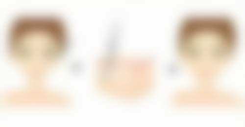 擅长项目详解