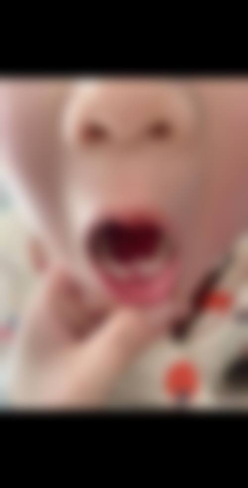 广东广州携手口腔擅长项目。