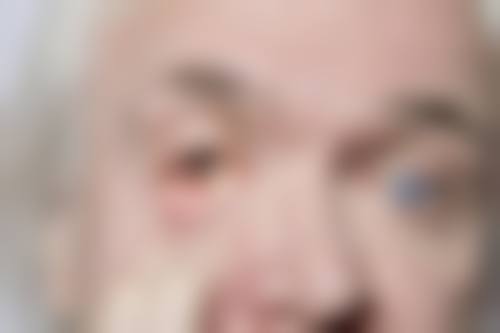 黄石市中 心医院眼科的预约方式