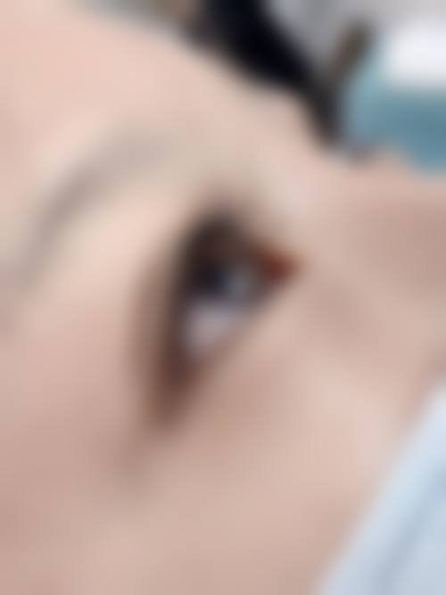 长沙岱高植发门诊部患者常见问题解答(精选)