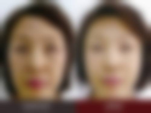 鞍山任凌欣医疗美容诊所治疗反馈与口碑评价。