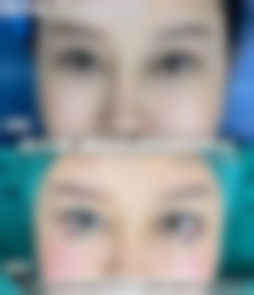 安徽医 科 大学附属巢湖医院眼科治疗反馈与口碑评价。