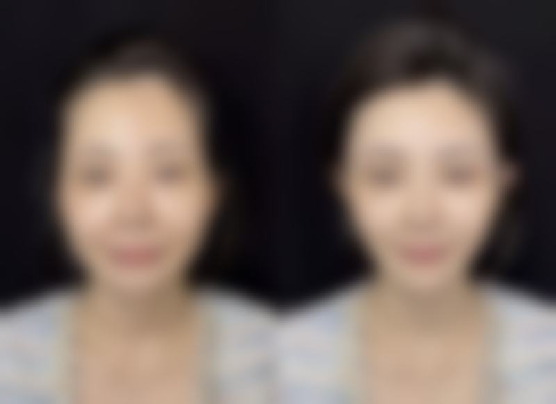 韓國千芊妍女性醫院適合邊類人群?呢3類姊妹更啱去!