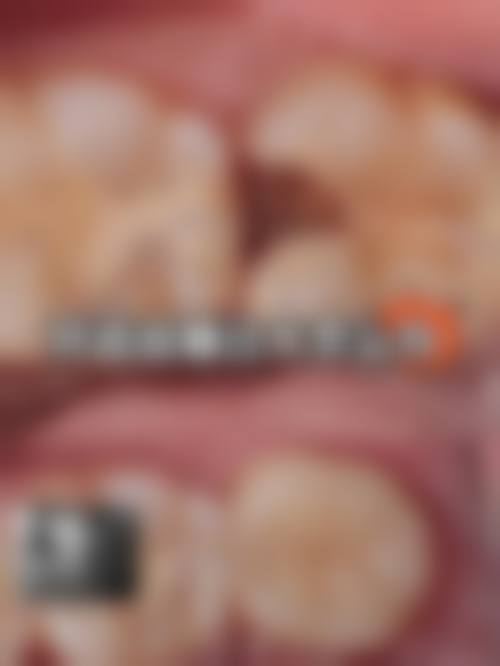 南宁玉齿口腔门诊部门诊营业时间。