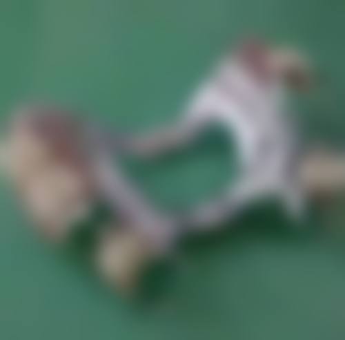 长沙锐思口腔门诊部治疗反馈与口碑评价。