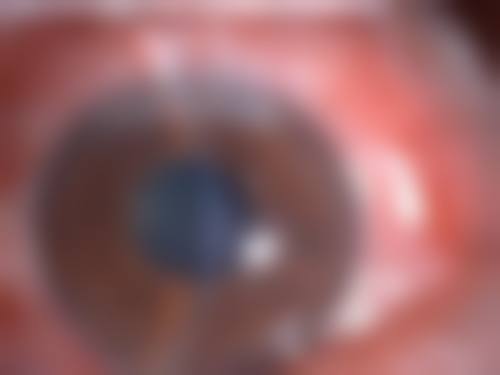 哈尔滨市第一医院眼科口碑评价
