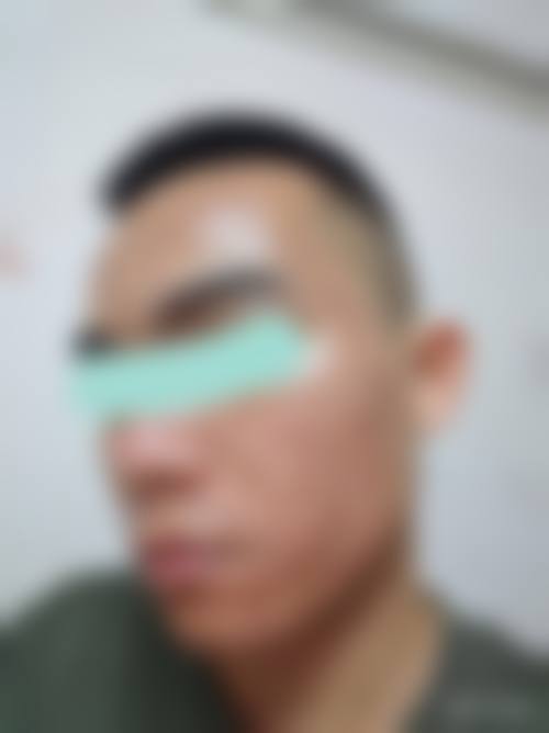 赣州欣范医疗美容门诊部治疗反馈与口碑评价。
