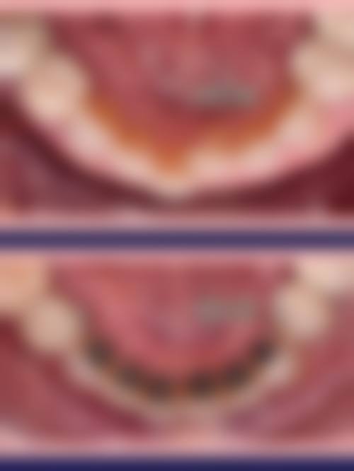 预约优惠活动