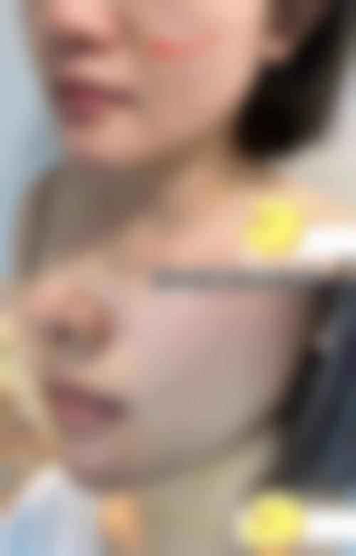 预约优惠活动