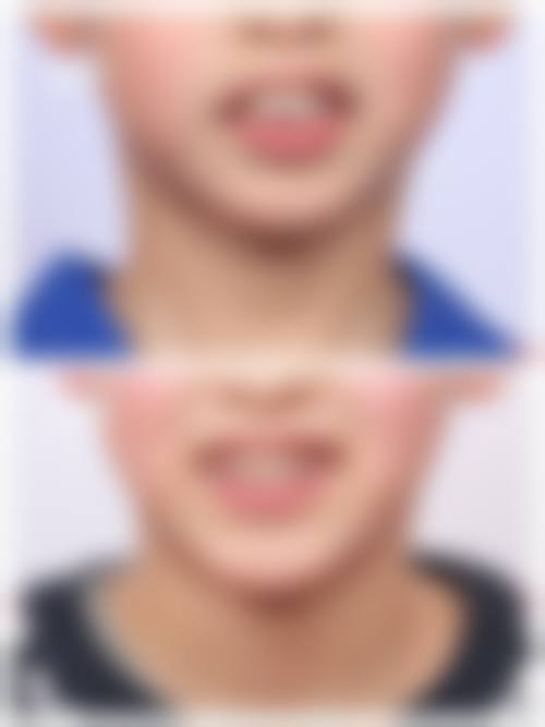 优惠活动详情：原价XXX元-优惠价XXX元，限时预约