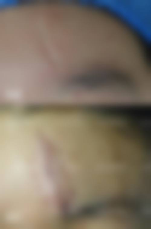 十、患者常见问题解答(精选)