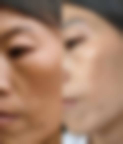 韩国Dal:B整形外科治疗反馈与口碑评价。