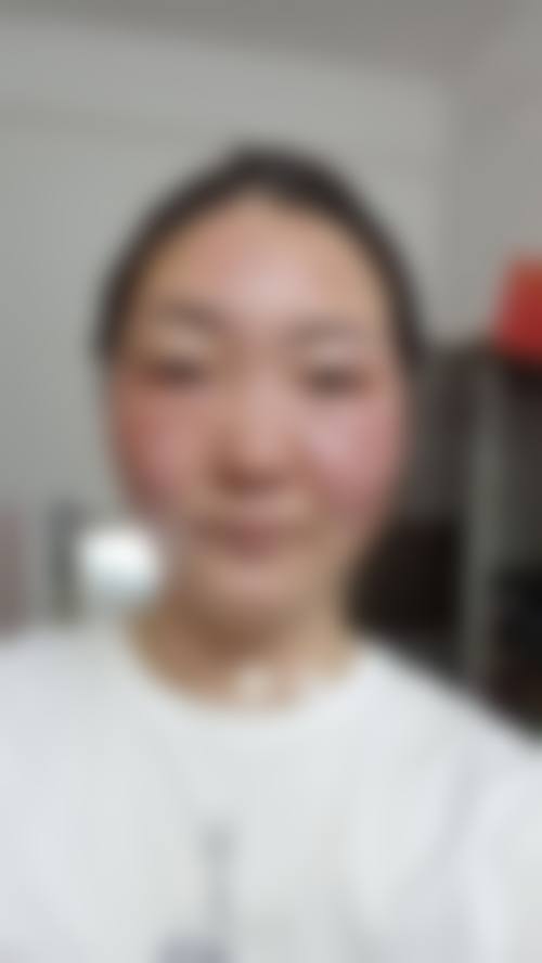 韩国Dal:B整形外科预约挂号方式。