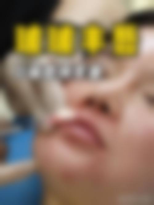 五、其他瘦脸方式