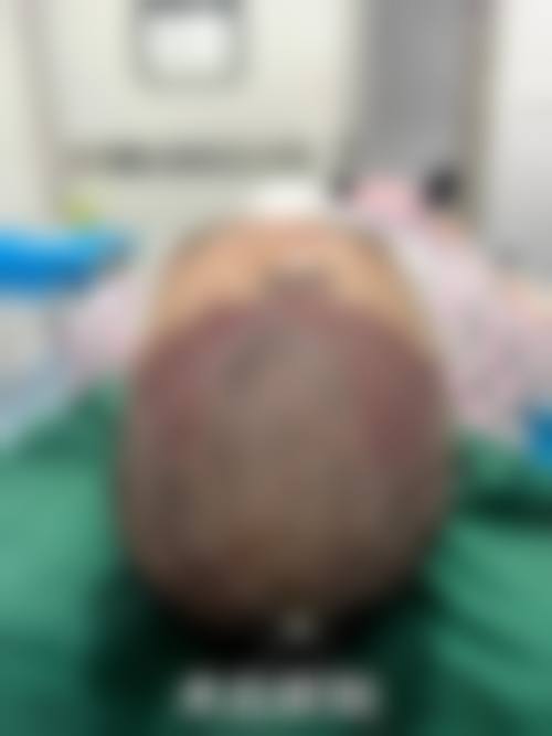优惠活动详情——多项项目限时特别优惠