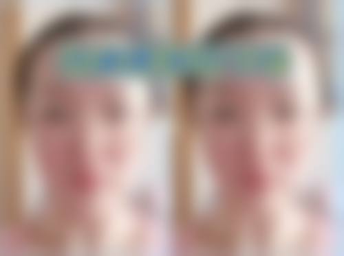 成都中瑞蜜美医疗美容诊所治疗反馈与口碑评价。