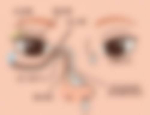 临床实例分享