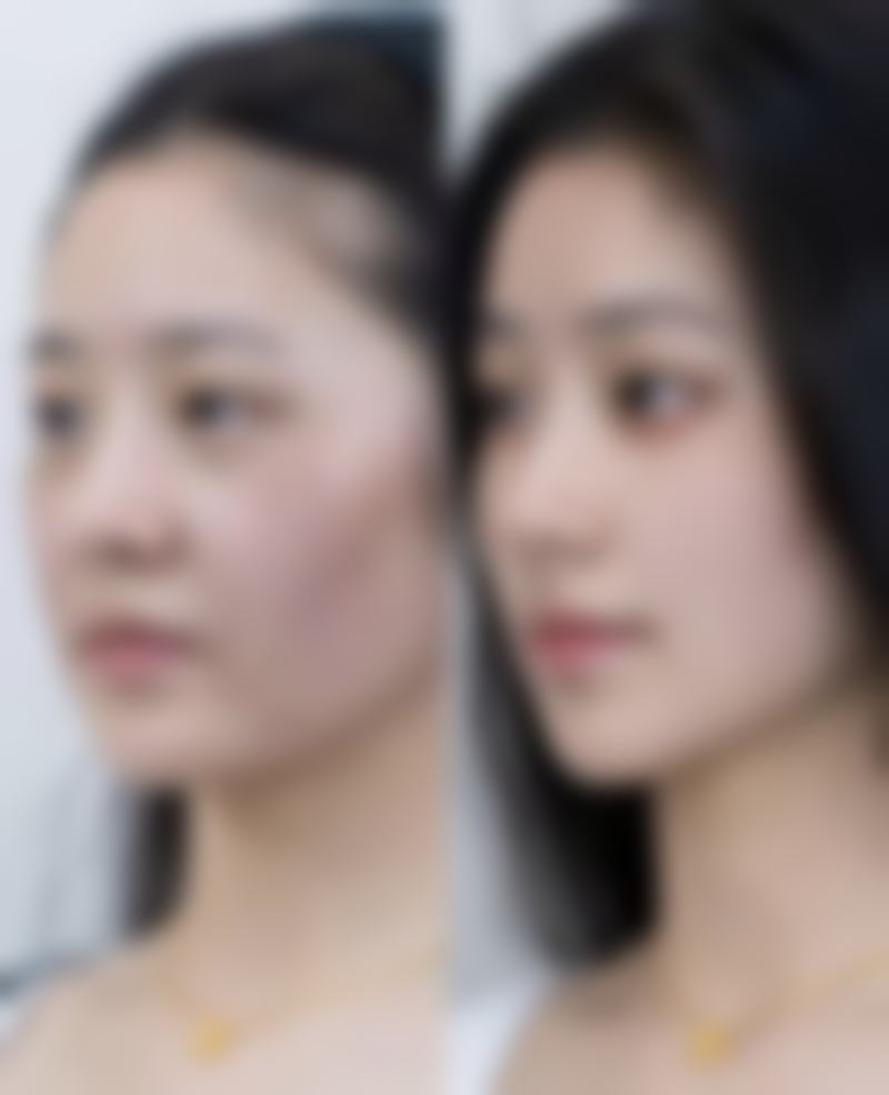 韓國大眼睛整形外科點樣預約?BeautsGO 3步直連攻略(附港澳專屬通道)
