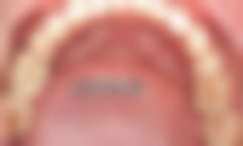 临床实例分享:别人在董文波医生这治好过吗?