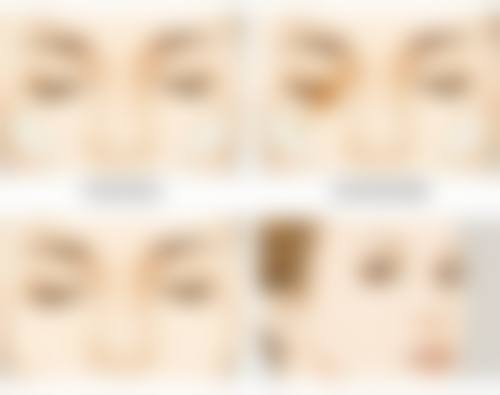韓國banal整形外科醫院怎麼預約掛號？2026最新預約攻略：5步流程+避坑必睇！