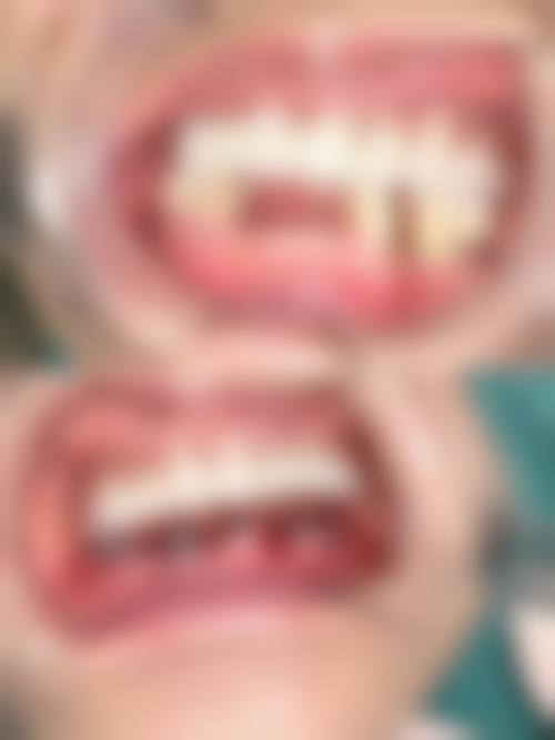 广东佛山顺德陈村微笑口腔预约挂号方式。