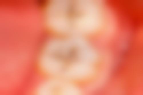 擅长项目详解:董文波医生能解决我的牙病吗?
