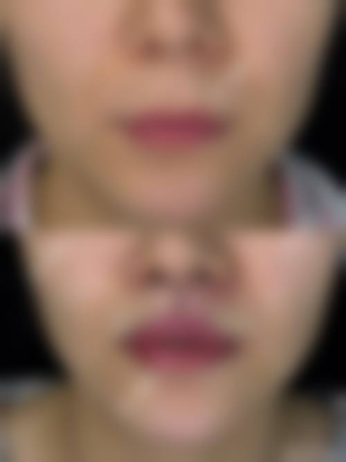 结语与预约号召