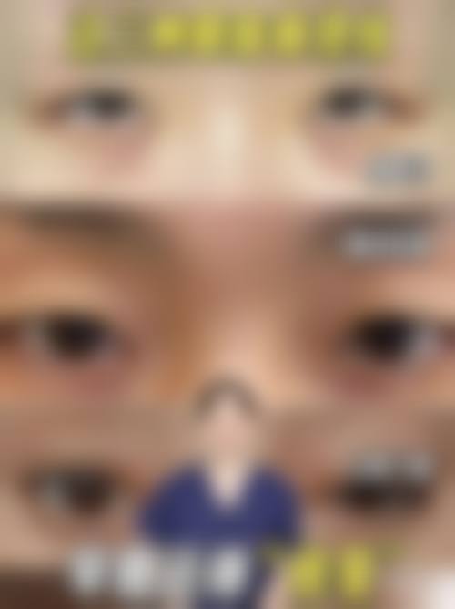 十一、患者常见问题解答(精选)