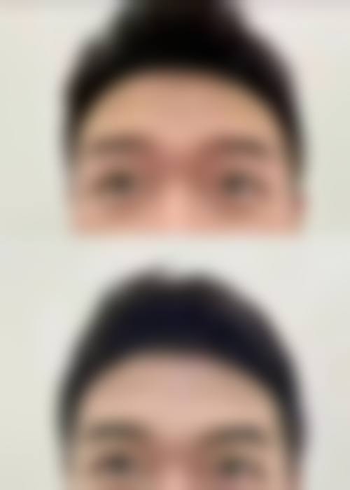 层流手术室与设备环境
