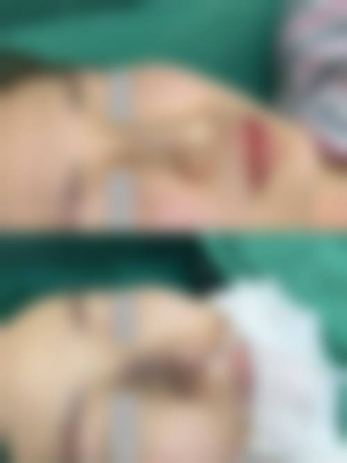 东莞莞城天后整形医院项目价格情况。