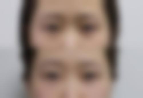 湘南美容 八王子擅长项目。
