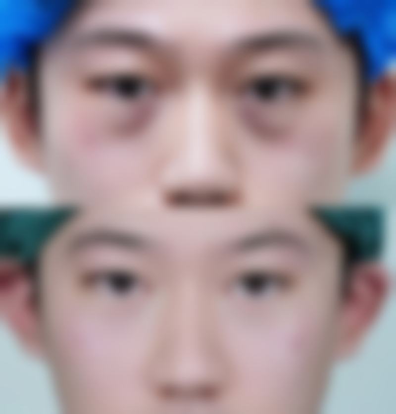 二、完整修复期时间线是怎样的